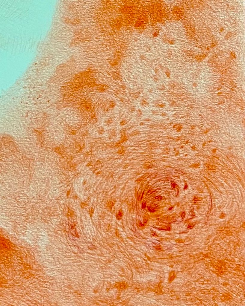 Red on White detail 5